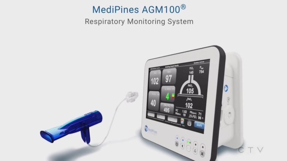 Lung function monitoring device